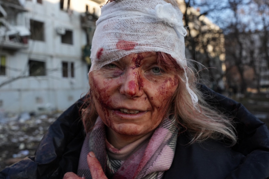 Femeie ucraineană rănită